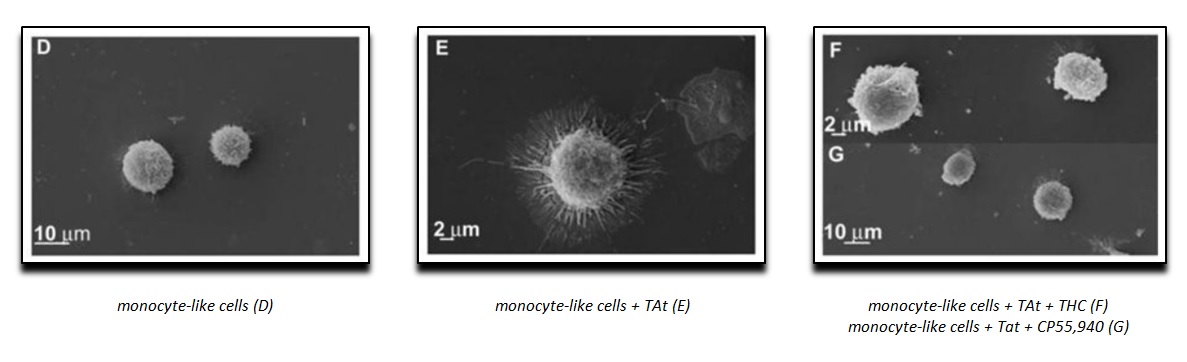 Efeito inibidor da adesividade e consequente morte celular de células monocyte-like após 2 horas de tratamento com THC e CP55,940 agonista canabinoide do receptor CB2. (Microscopia eletrônica de varredura) [PubMed] http://www.ncbi.nlm.nih.gov/pmc/articles/PMC4089388/