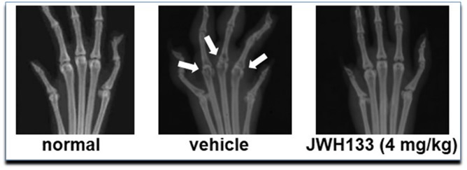 As setas apontam a ação osteoclástica nos ossos periarticulares, é possível observar a destruição óssea induzida pela artrite e a preservação, das mesmas articulações, após tratamento com agonista canabinoide em modelo experimental. [PuBMed] http://www.ncbi.nlm.nih.gov/pmc/articles/PMC4243420/pdf/12891_2013_Article_2224.pdf