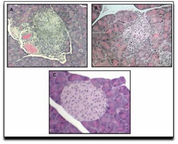Redução do infiltrado inflamatório caracterizado pela redução do número de linfócitos em lâminas de anatomia patológica, corada por HE. A) Sem tratamento. B) Veículo inerte. C) tratamento com CBD. [PubMed] http://www.ncbi.nlm.nih.gov/pmc/articles/PMC2270485/ 