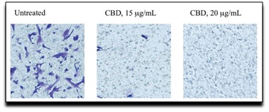 Efeito antineoplásico do CBD em células de neuroblastoma humanas (SK-N-SH) após 24 horas da administração [PubMed] http://www.ncbi.nlm.nih.gov/pmc/articles/PMC4791143/pdf/conc-23-s15.pdf 