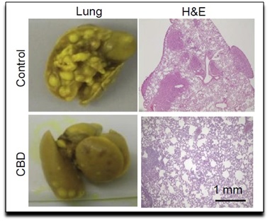 Ação antineoplásica do CBD, contra câncer de mama em modelo experimental, documentada pela Universidade de Ohio (EUA) [PubMed] http://www.ncbi.nlm.nih.gov/pmc/articles/PMC4387115/pdf/nihms657004.pdf